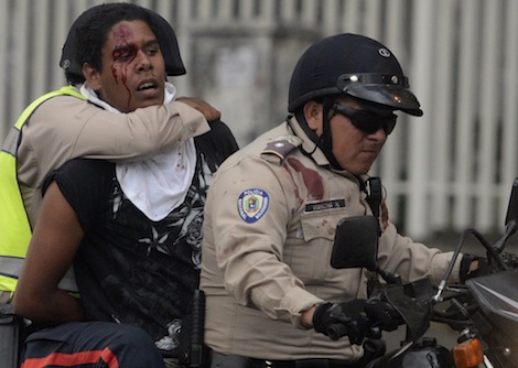 VENEZUELA-POLITCS-PROTEST