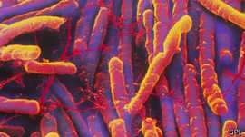 La bacteria C. difficile es una de las más difíciles de tratar y muchas veces los antibióticos no funcionan.