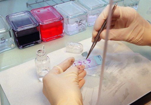 Un investigador examina tejidos de ratones de laboratorio en Francia.