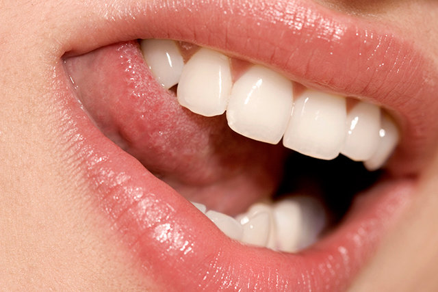 Una sonrisa bonita y con los dientes bien blancos son la mejor carta de presentación