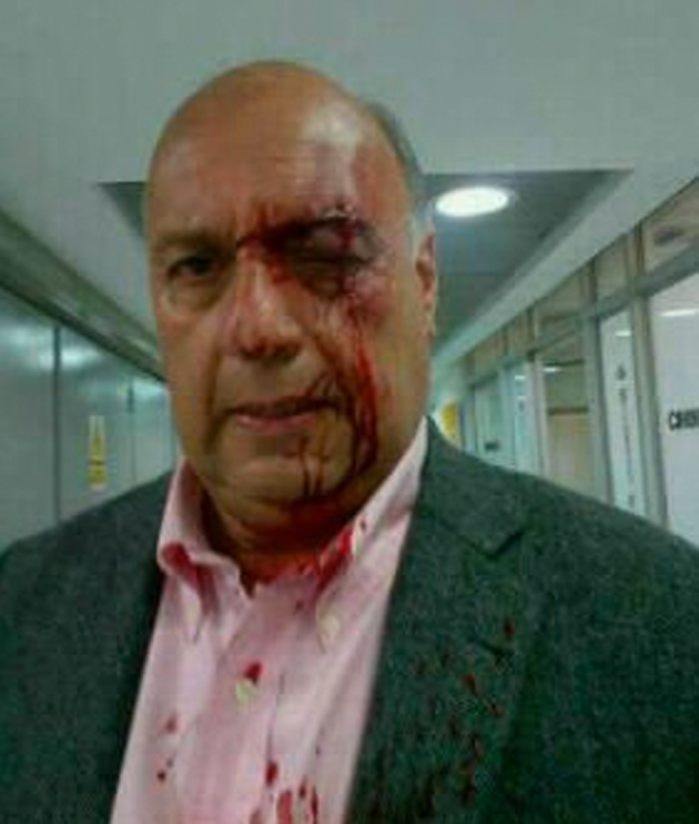 El diputado por Mérida William Dávila, fue herido en el rostro.