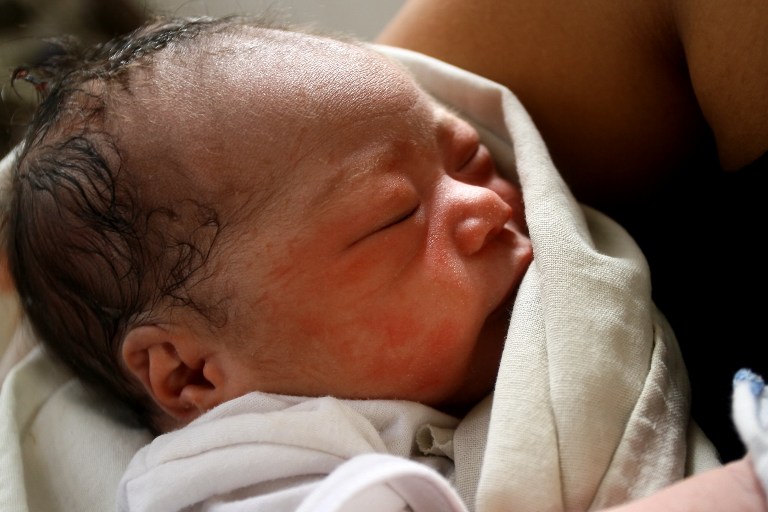 "Es la primera vez que nace aquí un bebé. La niña está bien y hemos conseguido parar la hemorragia de la madre", dice. Foto AFP