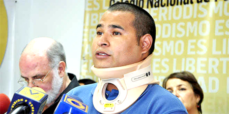 La fiscalía ordenó que se practique el reconocimiento médico legal al reportero gráfico Jorge Santos Castillo.