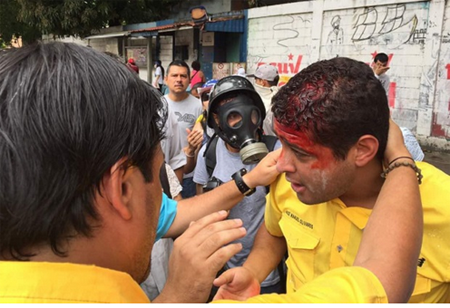 José Manuel  Olivares cuando era atendido por paramédicos luego del impacto de la bomba de gas lacrimógeno.