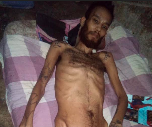 La situación de la salud del reo Ángel Lasso Ávila  es crítica: En seis meses desde su diagnóstico, ha perdido entre 35 y 40 kilos de peso