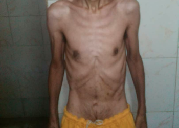 El preso José Alexander Bastidas presenta un cuadro de desnutrición