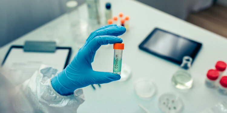 Scientist hand showing vial with vaccine in the laboratory. Selective focus on vial in foreground